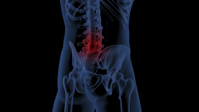 長く続く痛みに悩んでいる方には、整形外科的な症状や状態を伴っているように感じます